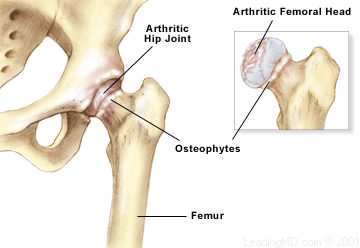 Anatomy of the Knee, Knee Specialist Fairfield, Shelton
